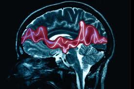 Gebelik ve epilepsi sara hastalığı Gebelik ve epilepsi sara hastalığı